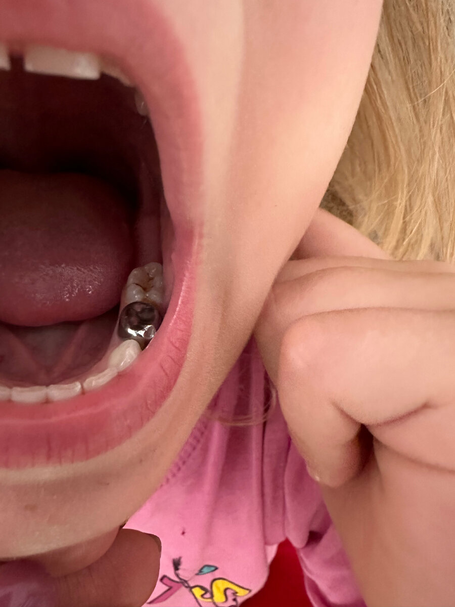 Детская стоматология: что важно знать каждому родителю