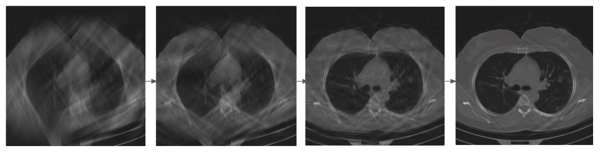 Изображение иллюстрирует зависимость качества КТ-снимка легких от количества проекций: чем больше проекций – тем лучше изображение