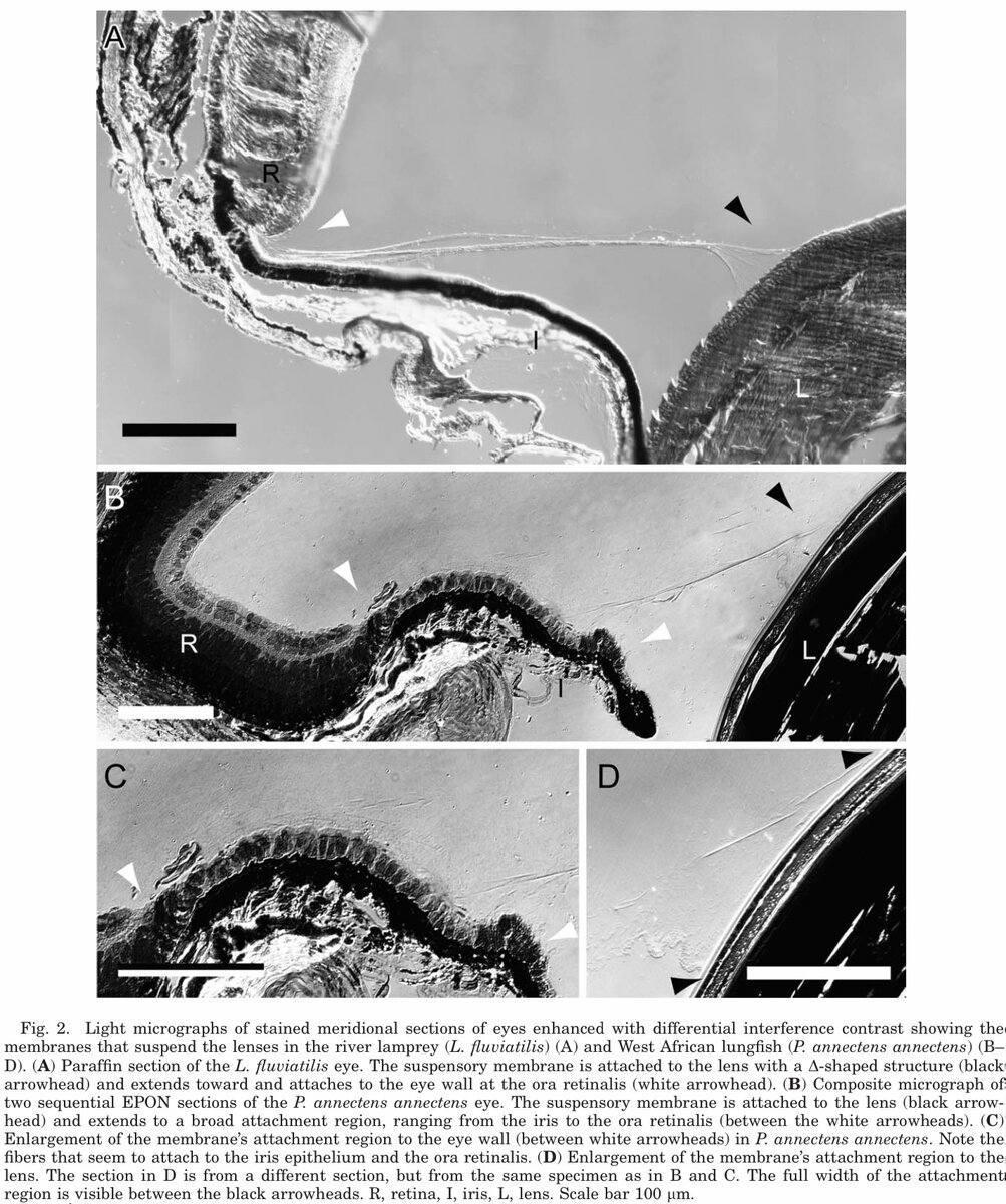 Крепление хрусталика в глазах миноги и рогозуба. Изображение взято из статьи Gustafsson, O.S.E., Ekström, P. and Kröger, R.H.H. (2010) A fibrous membrane suspends the multifocal lens in the eyes of lampreys and African lungfishes