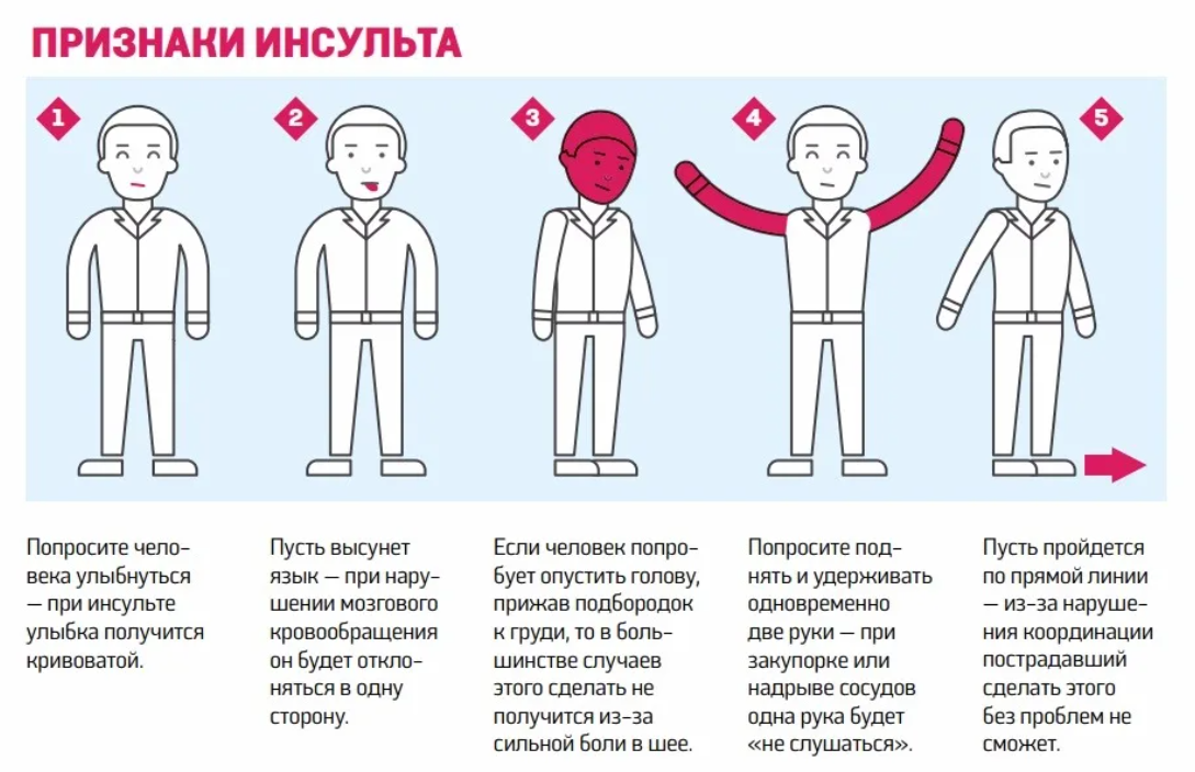 Может ли быть инсульт. Первичные признаки инсульта. Сигнальные симптомы инсульта. Основные критерии инсульта. Симптомы инсульта у подростков