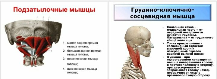 Боль в основании черепа