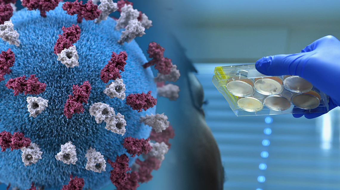 https://www.iaea.org/sites/default/files/styles/original_image_size/public/rrt-pcr-1140x640.jpg?itok=e2XhXmmx