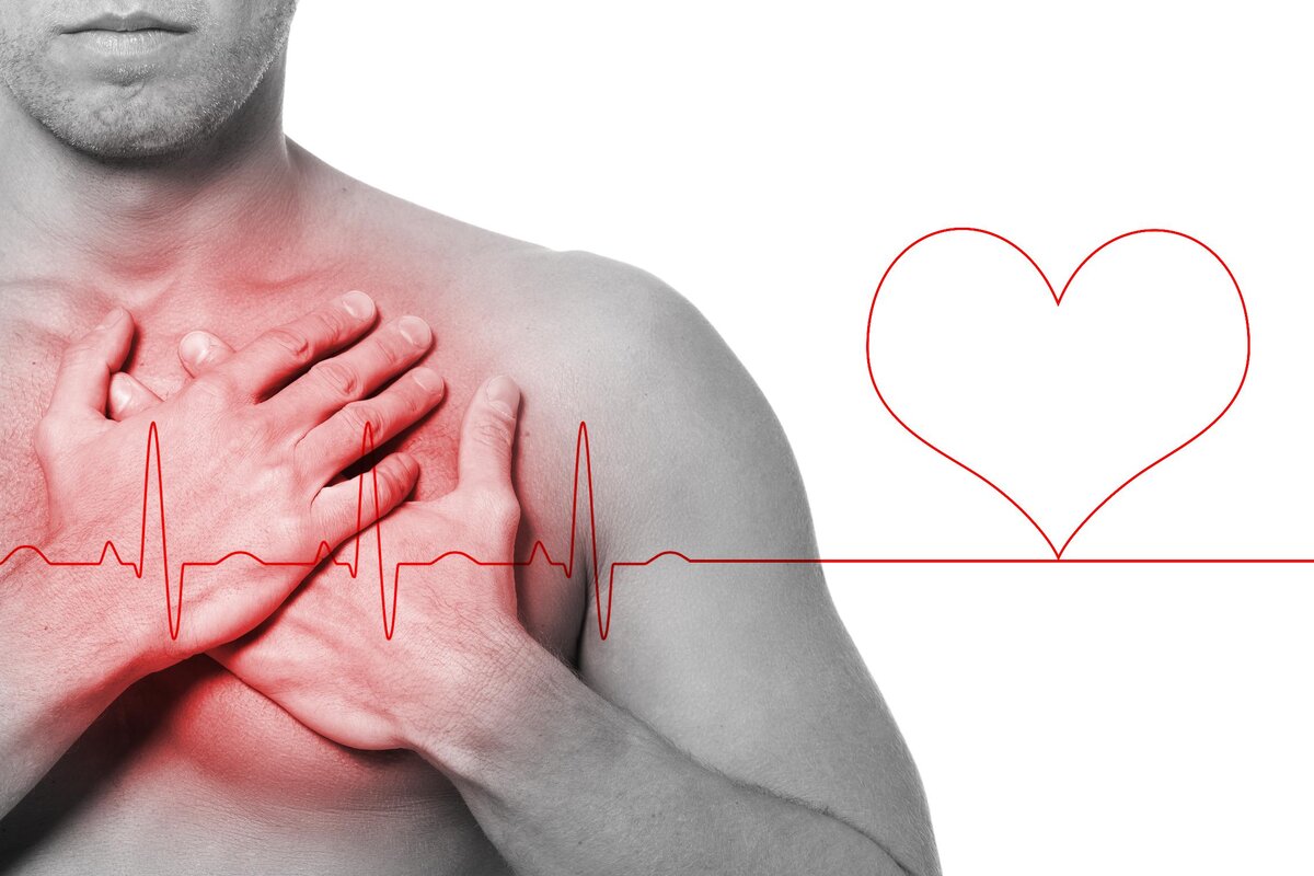 Причины болей в груди и как определить, относятся ли они к сердечным  проблемам | Клиника ЭКСПЕРТ - Гастро-гепатоцентр | Дзен