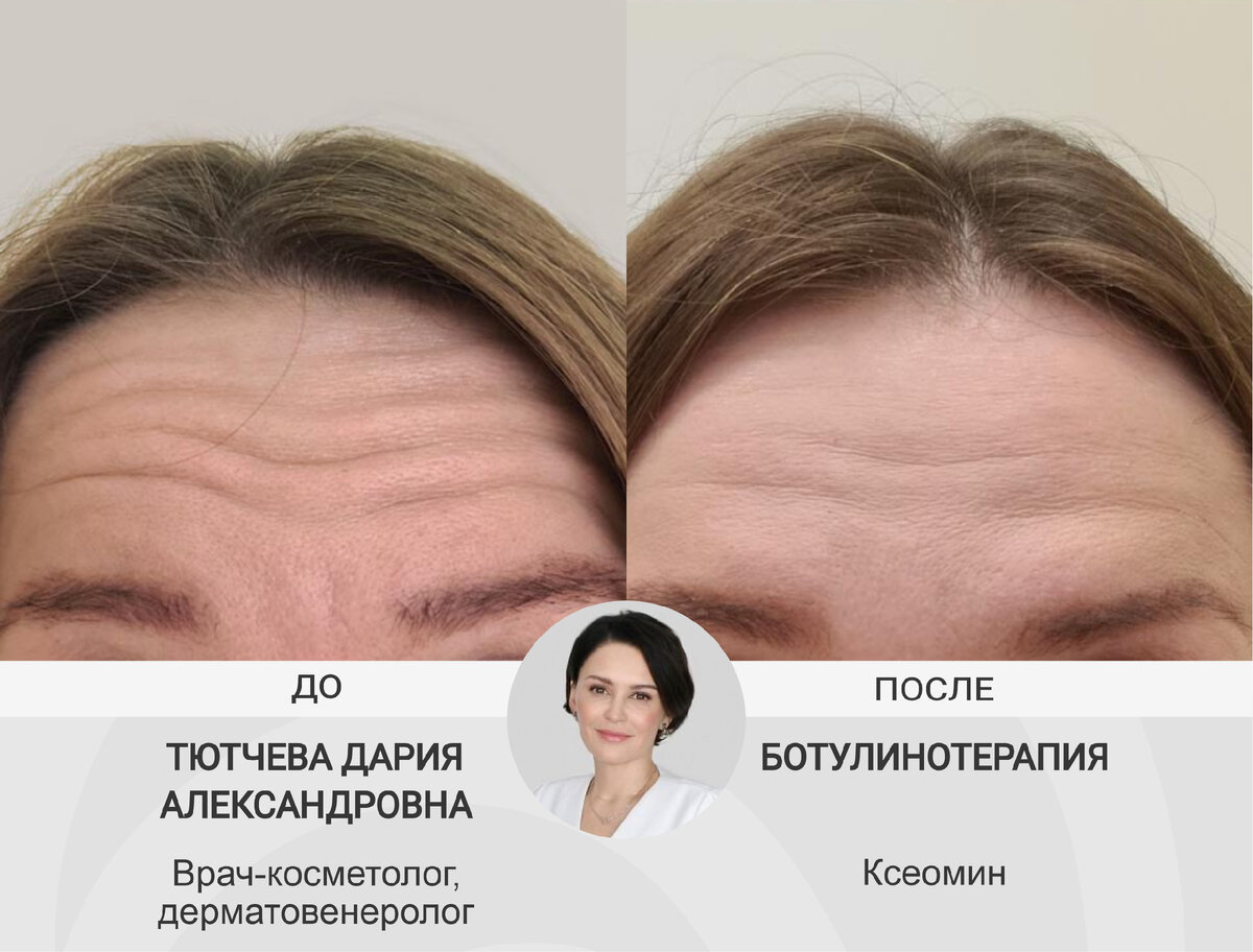 Зачем идти к косметологу, если нет видимых проблем с кожей. | GMTClinic:  красота через здоровье! | Дзен