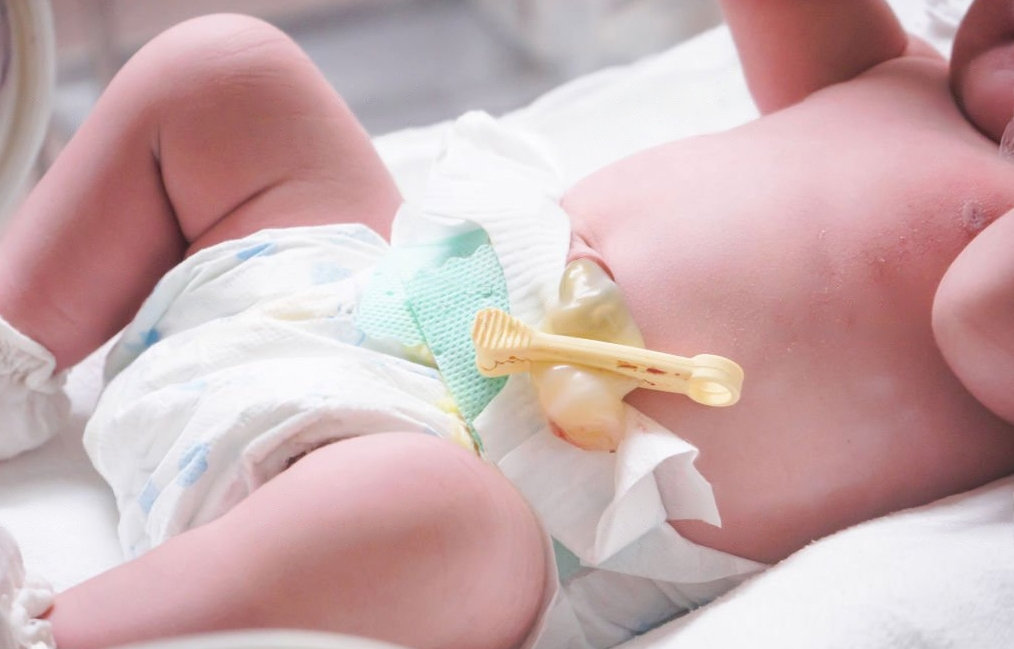 Пупок малыша 