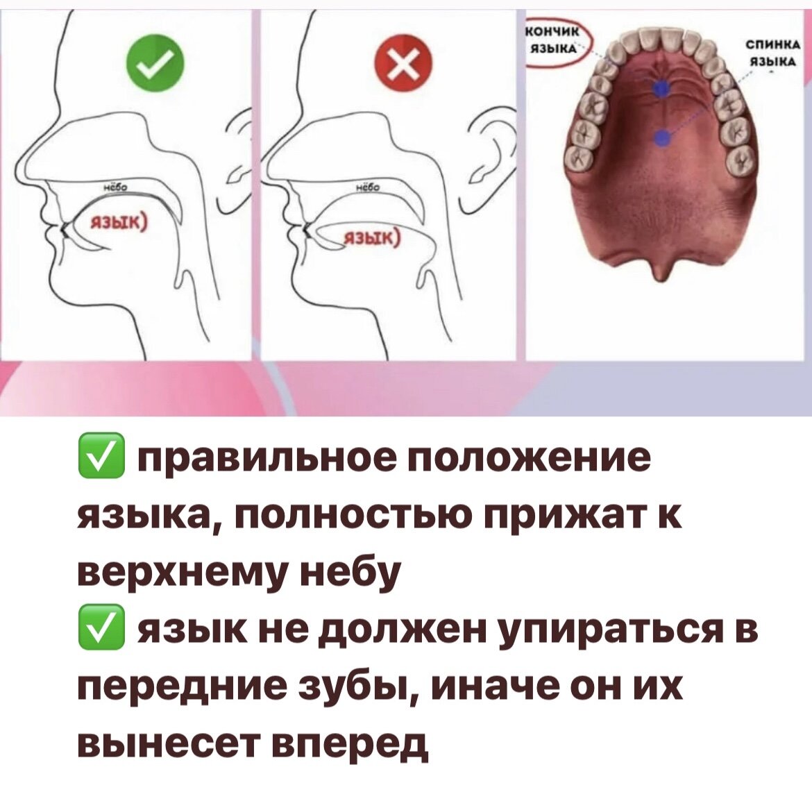 Положение языка