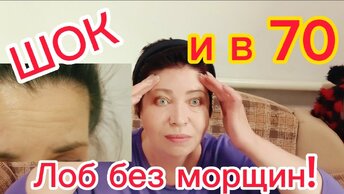 От МОРЩИН КРУЧЕ БОТОКСА! ЛУЧШЕ УКОЛОВ КРАСОТЫ!Даже если вам за 70 за 2 МИНУТЫ МОРЩИНЫ на ЛБУ РАЗГЛАДЯТСЯ!!! 💯%Результат с Первого раза!