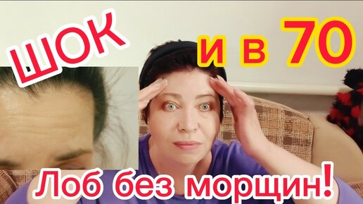 От МОРЩИН КРУЧЕ БОТОКСА! ЛУЧШЕ УКОЛОВ КРАСОТЫ!Даже если вам за 70 за 2 МИНУТЫ МОРЩИНЫ на ЛБУ РАЗГЛАДЯТСЯ!!! 💯%Результат с Первого раза!