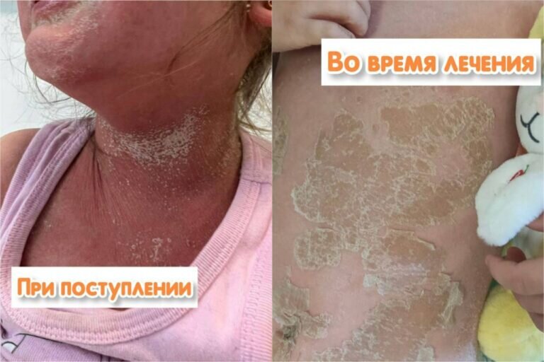    Оренбургские врачи спасли маленькую девочку, которая отравилась «Йодомарином» Белов Михаил Александрович