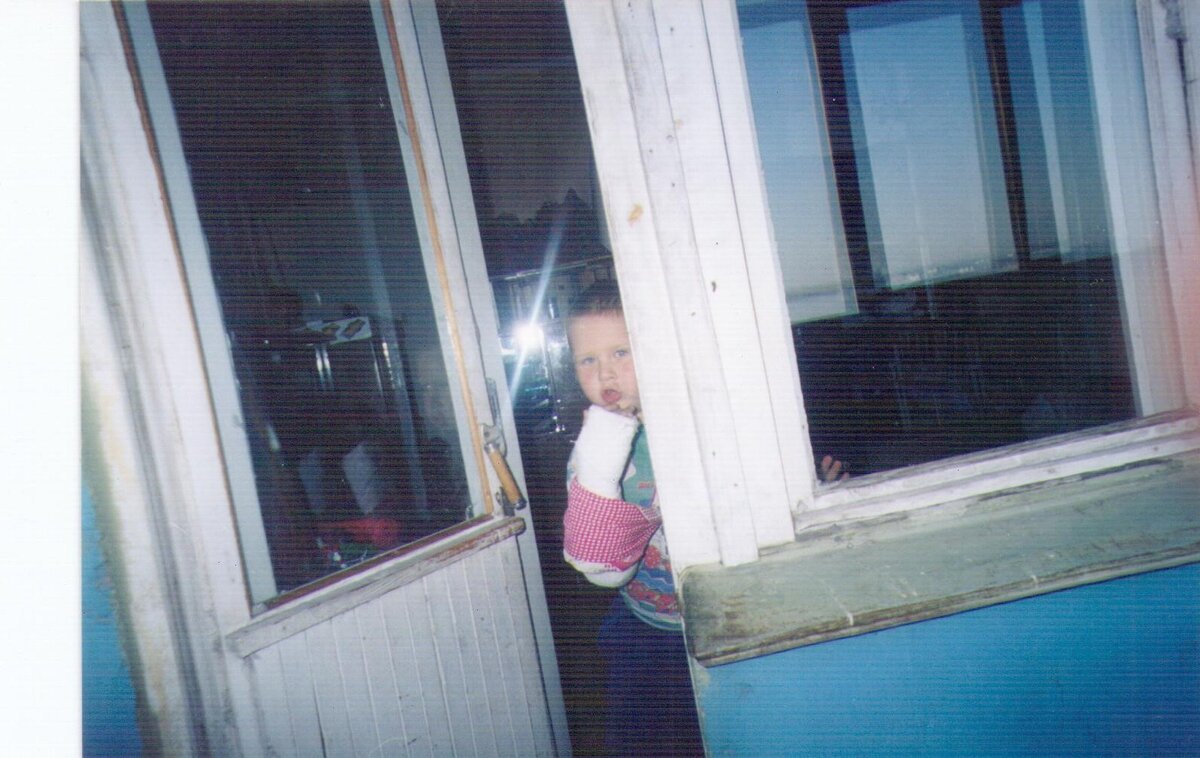 Без травм обходилось не всегда. На фото - результат прогулки на первое сентября первого класса