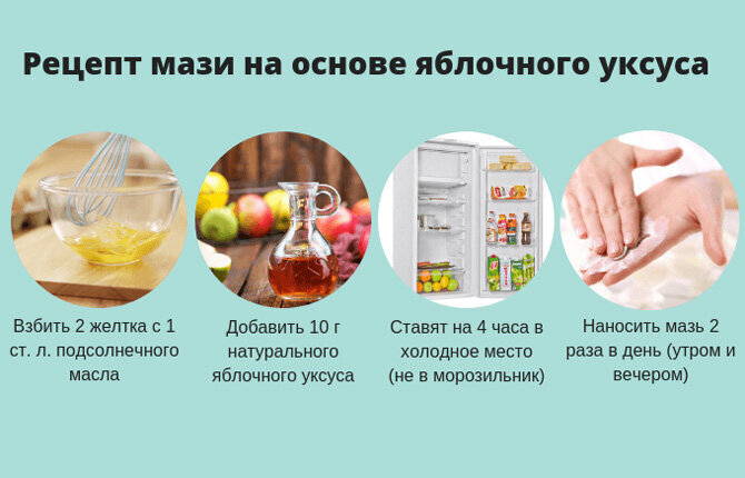 Продукты, полезные для суставов