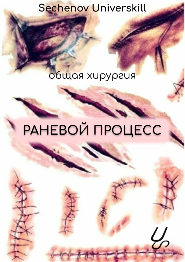 Sechenov universkill