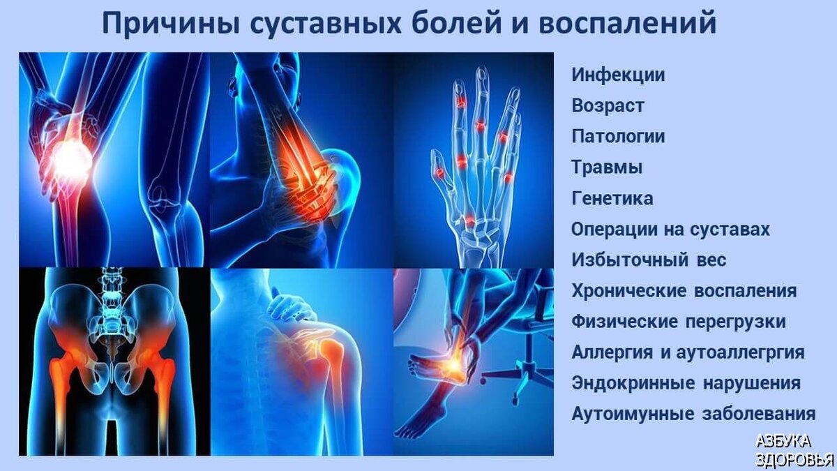 Причины болей в суставах