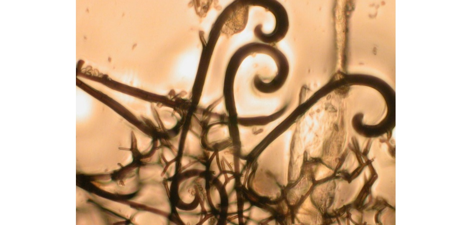 Аскокарп с придатками в виде крючков гриба Myxotrichum chartarum. Фото Татьяны Головиной, ЧелГУ.