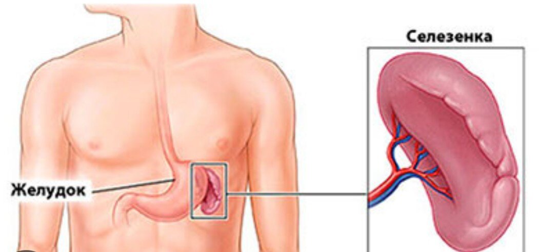 Селезенка болит симптомы