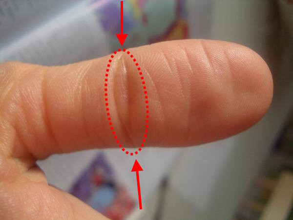 Пример Пхала Рекха, которая содержит большое ярко очерченное зерно.