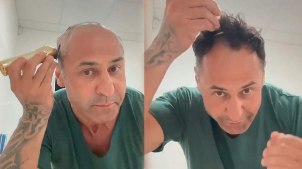 Стас костюшкин фото до и после