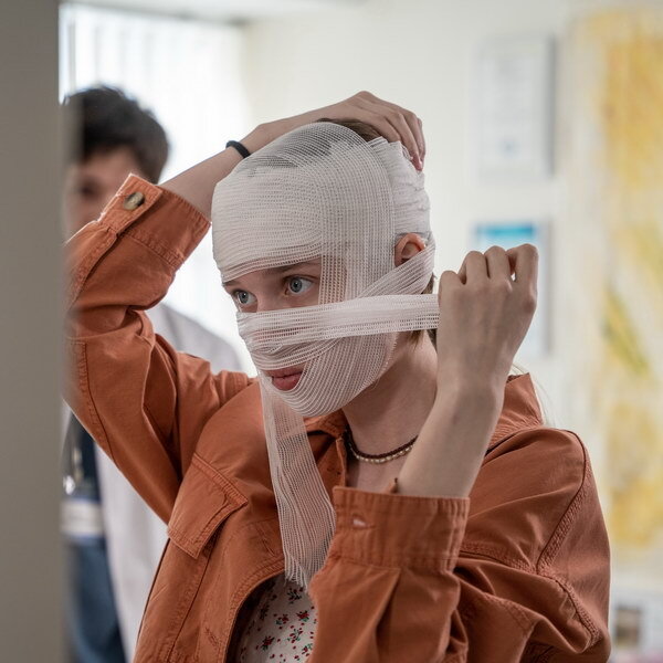     Варвара Володина, Кирилл Кяро и Регина Тодоренко покажут историю изуродованного подростка в «Некрасивой»