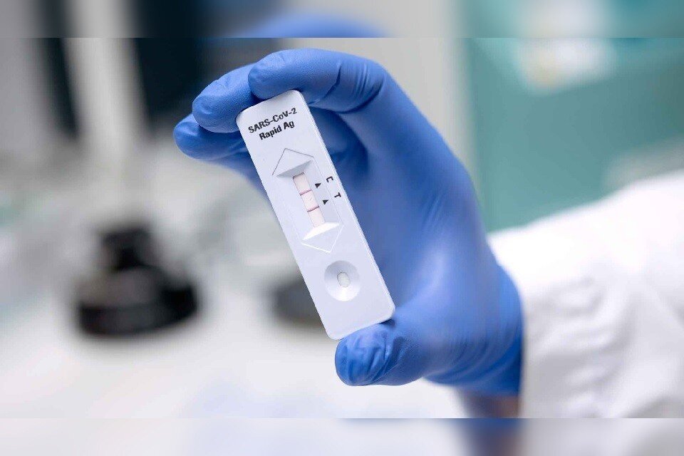     За сутки в Москве выявили еще 887 новых случаев заражения COVID-19  GLOBAL LOOK PRESS