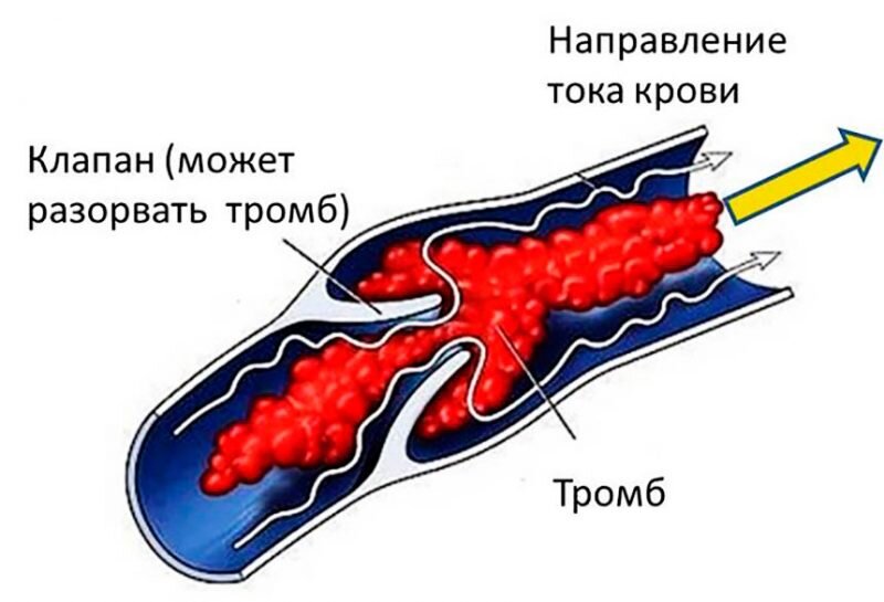 Рисунок из общедоступных источников