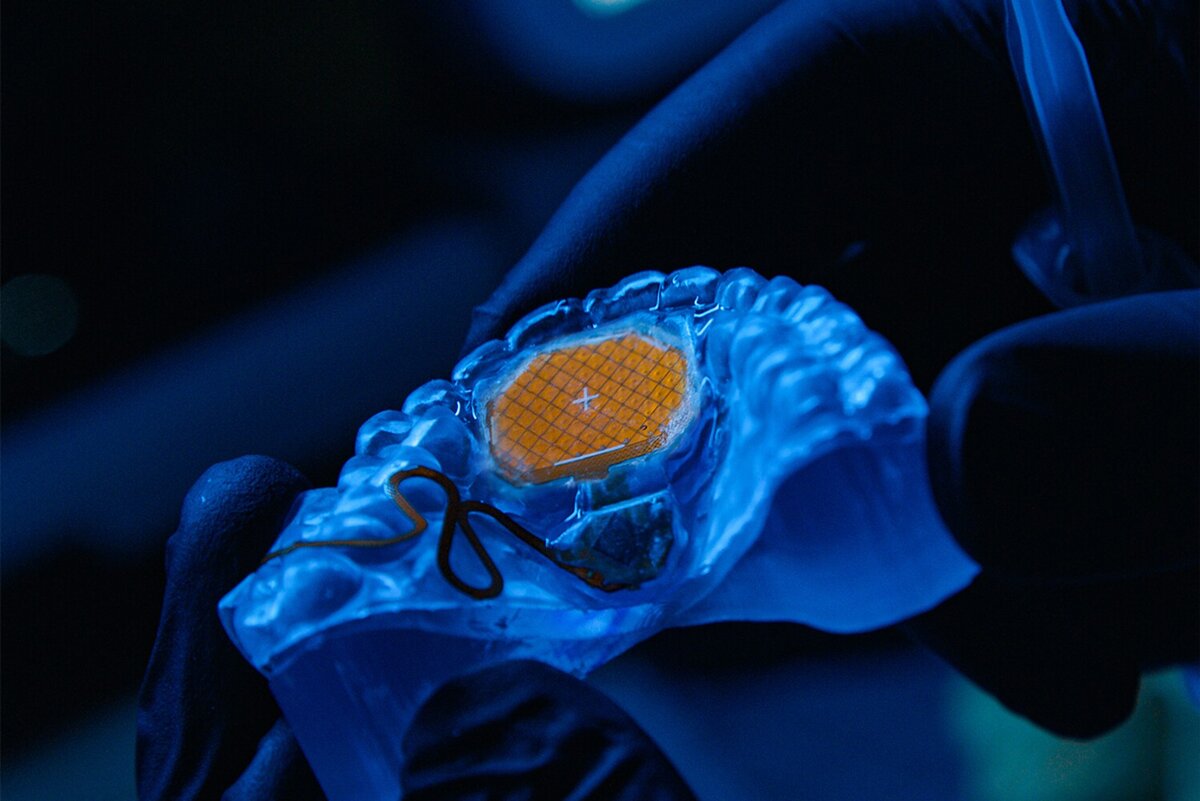    MouthPad Фото: Augmental