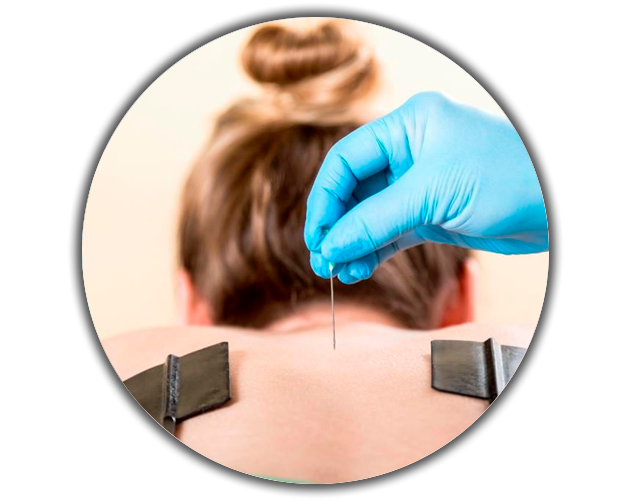 Втэс внутритканевая электростимуляция. Втэс внутритканевая электростимуляция. Метод герасимова внутритканевая электростимуляция позвоночник. Втэс по герасимову. Аппарат герасимова внутритканевая.