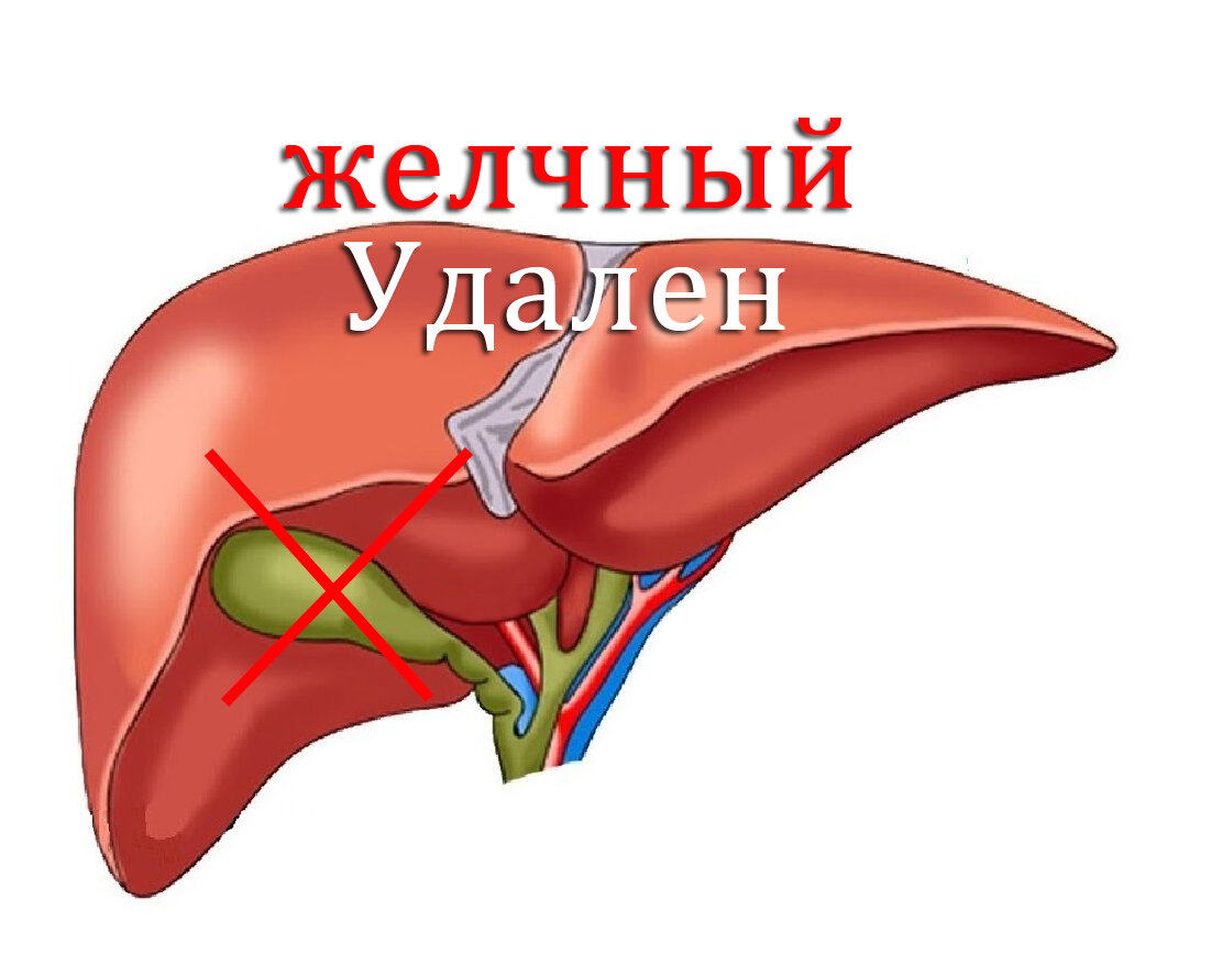 На желчный пузырь, небольшой мешочек, расположенный под печенью, часто не обращают внимания, пока он не начнет вызывать проблемы.