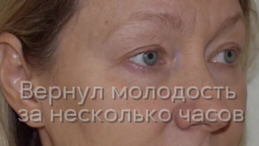 Клиника Пирогова | ВЕРНУЛИ МОЛОДОСТЬ ЗА НЕСКОЛЬКО ЧАСОВ! | Дзен