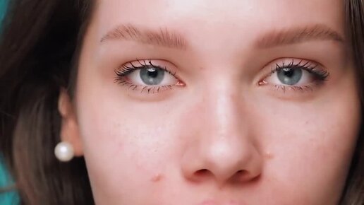 Клиника \"Время Красоты\" | Контурная пластика: Когда она необходима 👉 ...