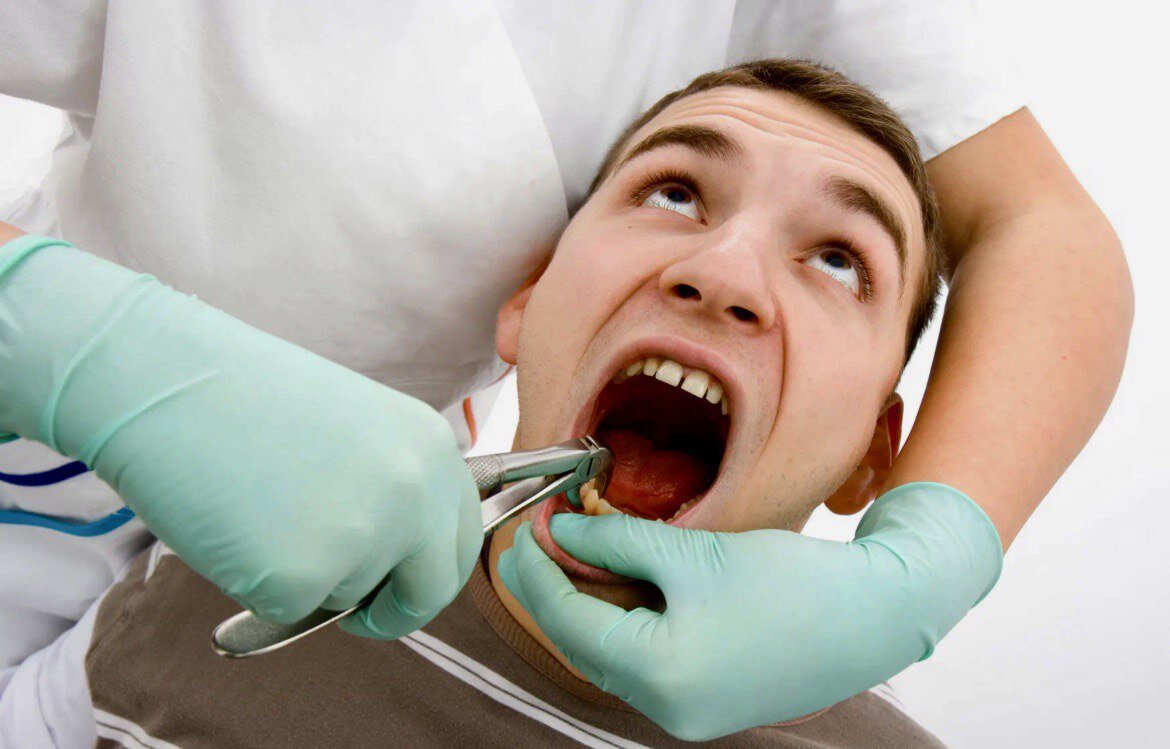 Что нельзя делать после удаления зубов?
