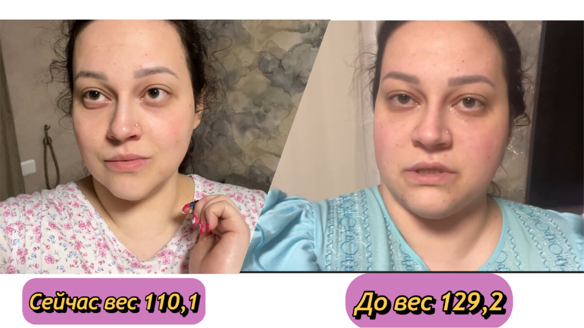 Из уставшего блинчика, в уставшего полублинчика 🙈 синяки под глазами стали выделяться сильнее👍🏼