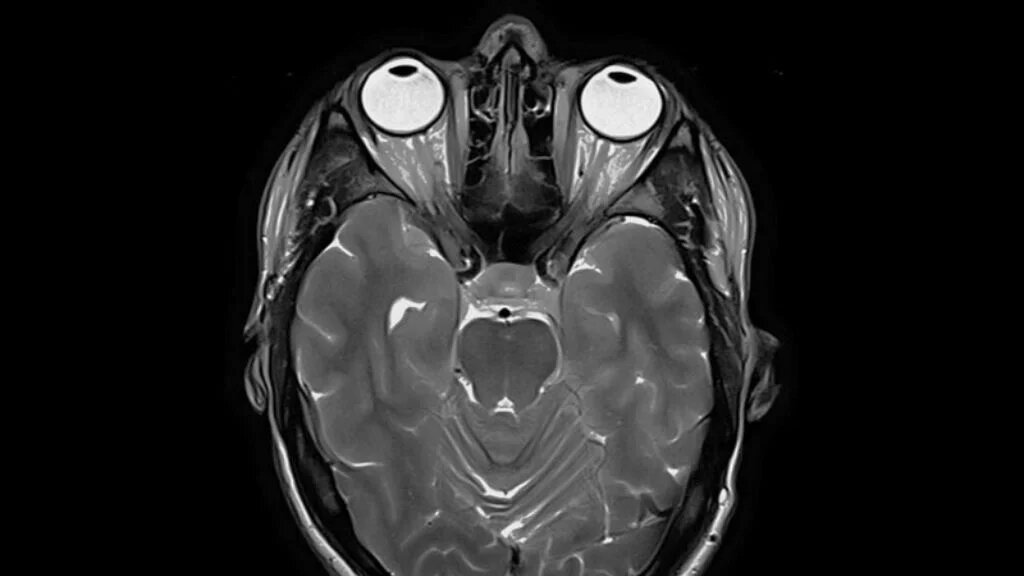Снимки кт с описанием. Хрусталик кт. Хрусталик кт. Хрусталик кт. Хрусталик кт.