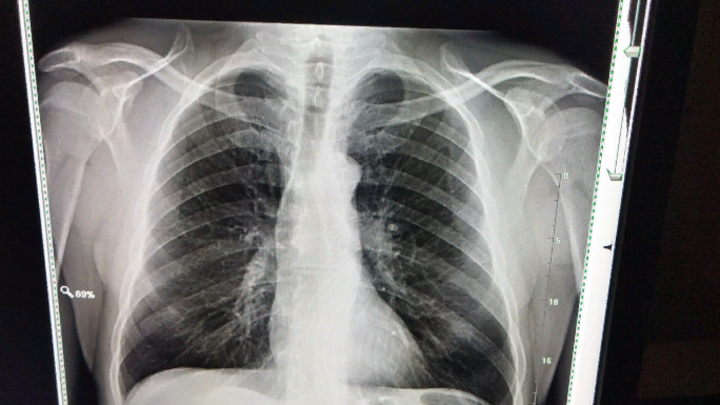 ФОТО: ZAMIR USMANOV/GLOBALLOOKPRESS