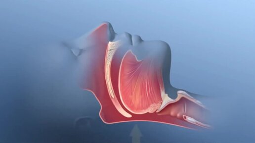Что происходит в глотке у многих полных людей, когда они засыпают?