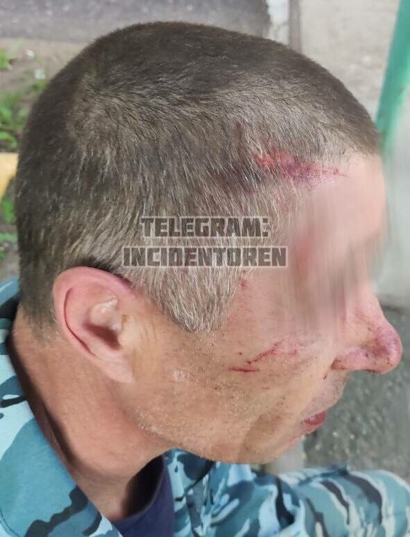    В Оренбурге хозяин бойцовской собаки натравил ее на пенсионера и отобрал у него телефон Белов Михаил Александрович