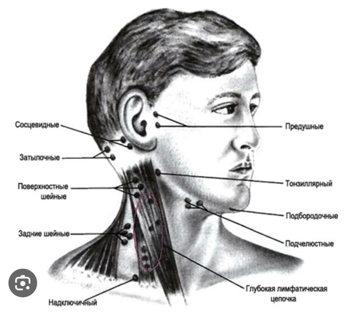 Воспаление лимфоузлов на шее: лечение, симптомы и причины шейного лимфаденита