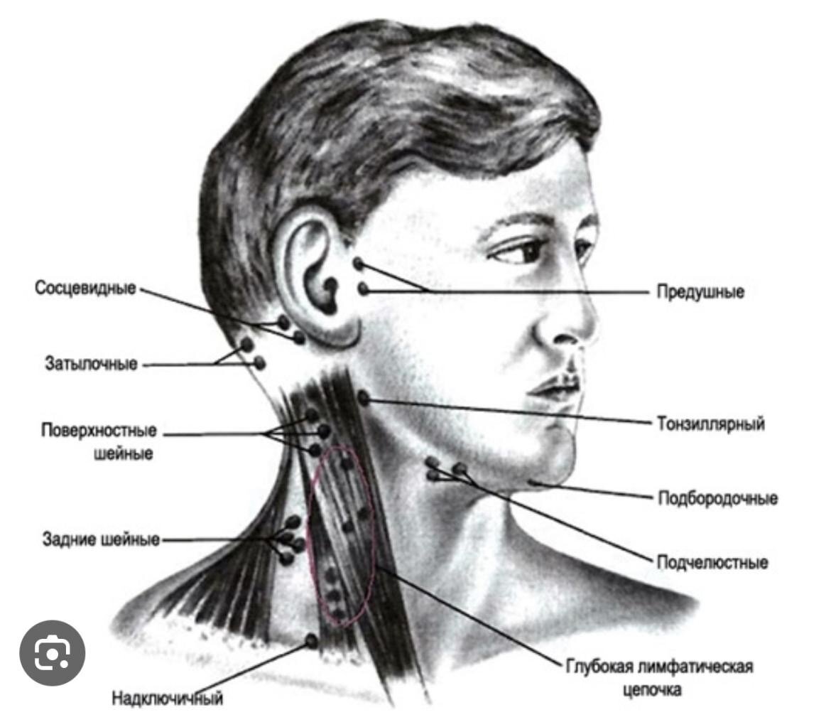 Болят лимфоузлы на шее. Подчелюстные лимфатические узлы. Лимфоузлы на шее расположение. Шейные и подчелюстные лимфоузлы. Лимфоузел подчелюстной на шее расположение.