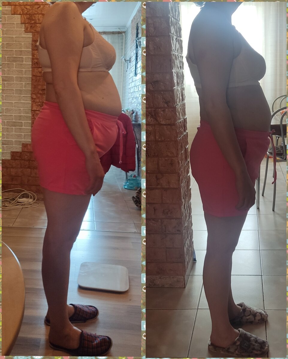 Лимфодреннажный массаж – безопасное физиотерапевтическое воздействие, направленное на восстановление и поддержание работоспособности лимфатической системы. В первые применившие массаж для лечения отеков. С тех пор прошло почти 100 лет, в течение которых массажные техники развивались и совершенствовались. Сегодня аппаратный и мануальный лимфодренажный массаж тела признан одним из самых результативных способов укрепления защитных сил организма, сохранения молодости и здоровья.