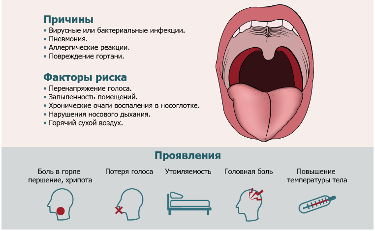 Острый ларингит