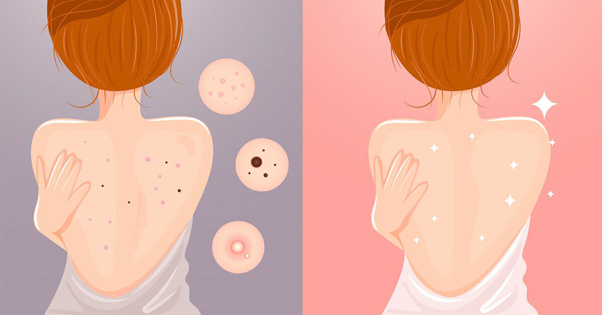 Картинка взята из интернета