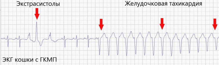 Различия в распространенности по возрастным группам