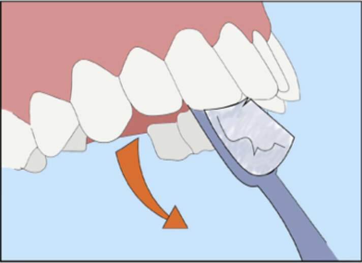 Секрет во рту. Метод Пахомова чистка зубов. Наши зубы это красота. Зубы 53 и 64.