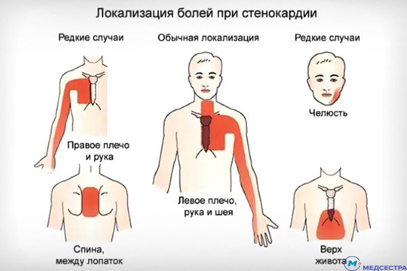 Грудина обозначена более тёмным цветом на среднем рисунке.
