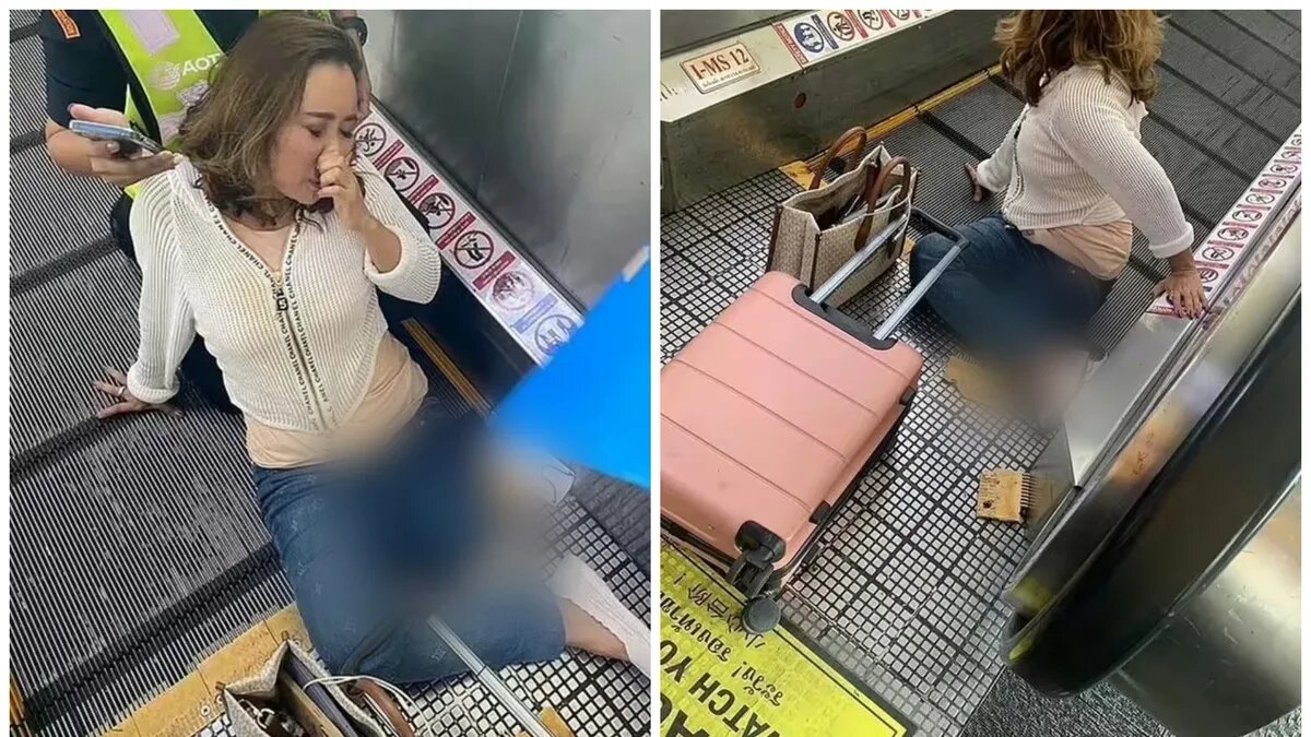 Пострадавшая туристка. Фото: express.co.uk