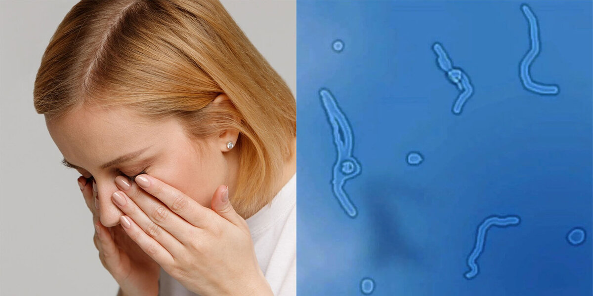    Мушки перед глазами есть почти у всех — некоторые люди просто не обращают на них внимание