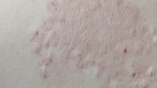 ЭЛЕКТРОЭПИЛЯЦИЯ МОСКВА | Как Вы думаете: стоит ли мужчинам делать ...