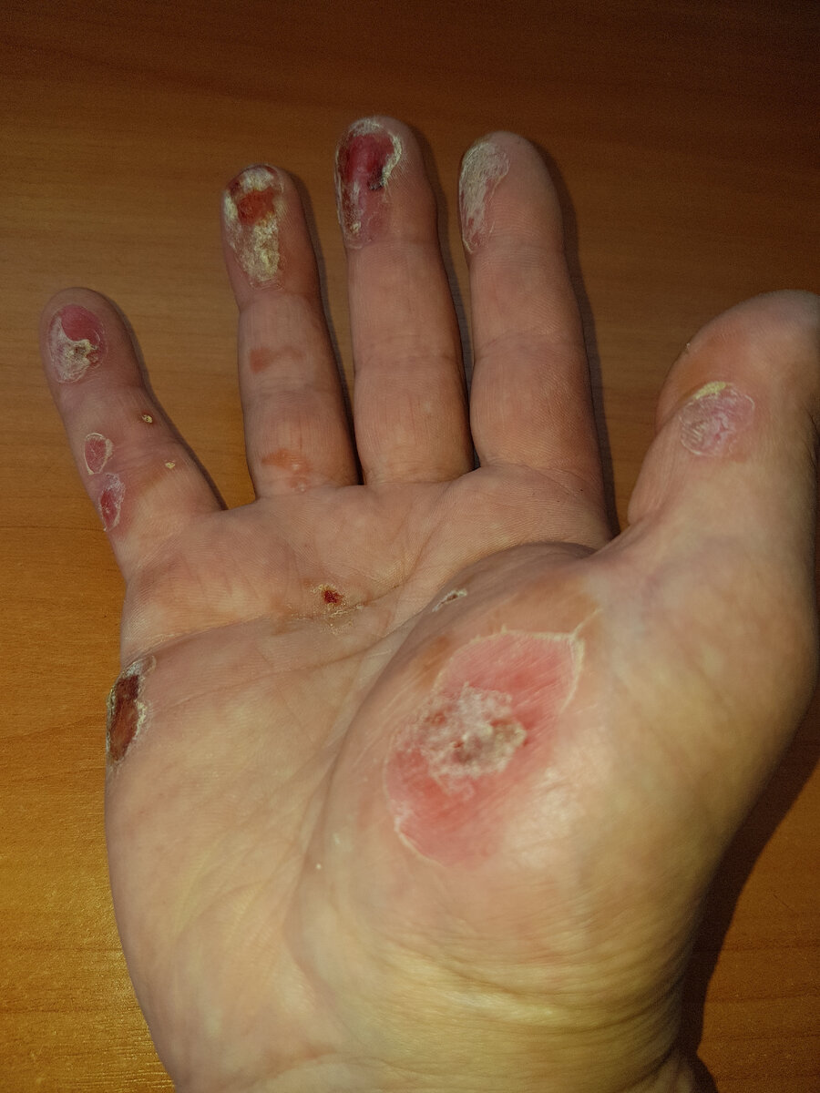 Уже подсыхает