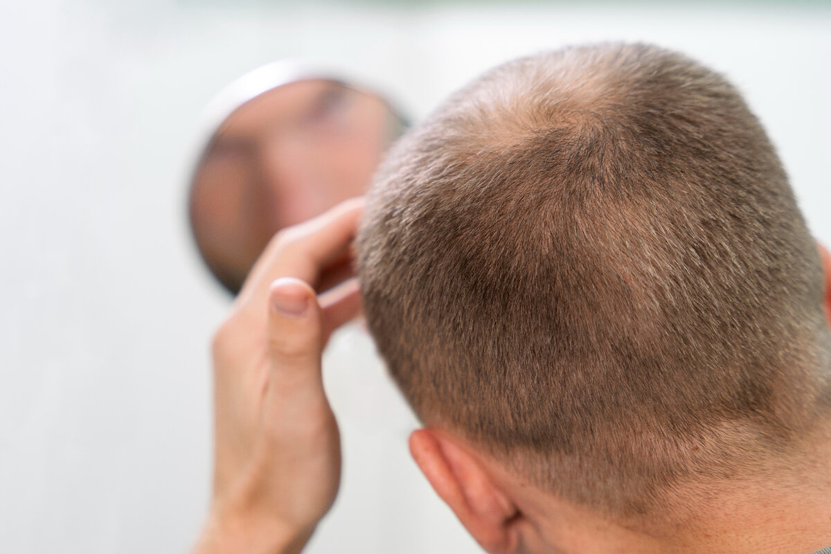 Решение проблемы выпадения волос эффективность биотина