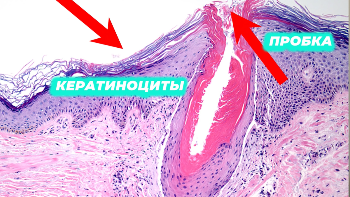 Пупырышки под микроскопом.