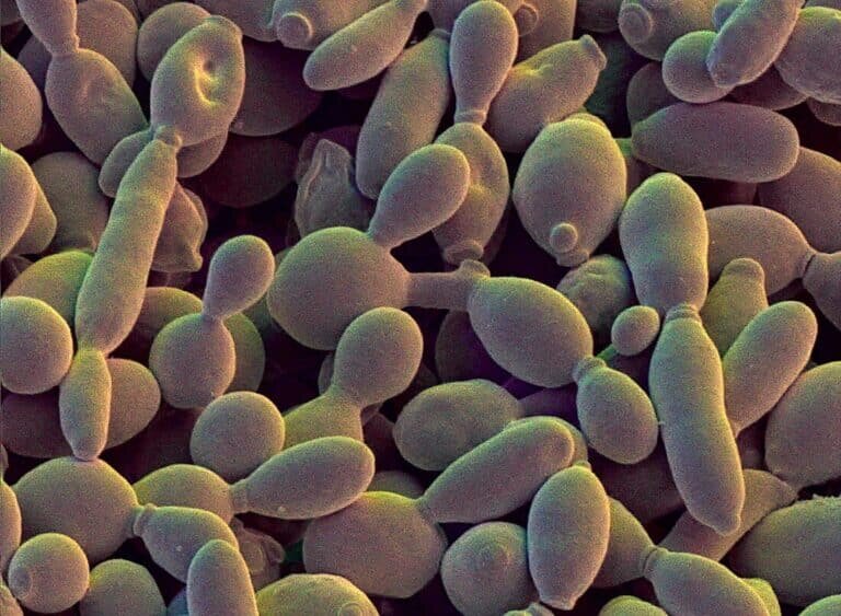    Пекарские дрожжи Saccharomyces cerevisiae / © Science Photo Library, David Scharf